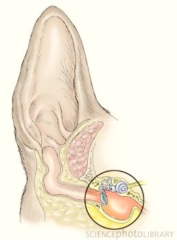 There are three types of dog ear infection.